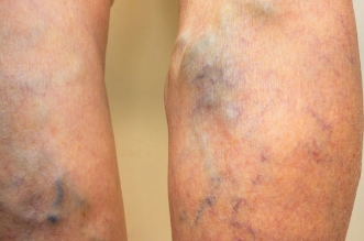 49087DC6-1A5E-450E-BF09-720E1B870F70